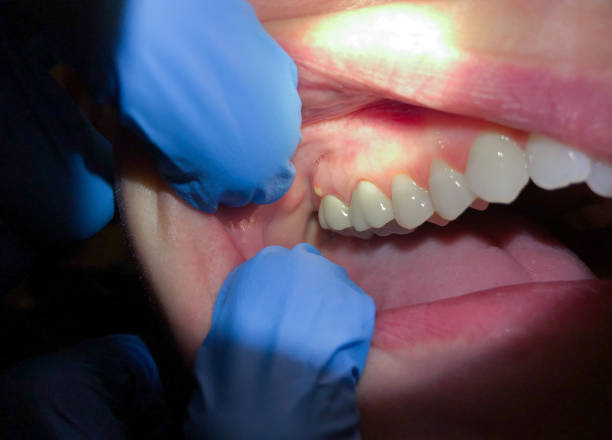 Best Pediatric Emergency Dentist in Greencastle, PA
